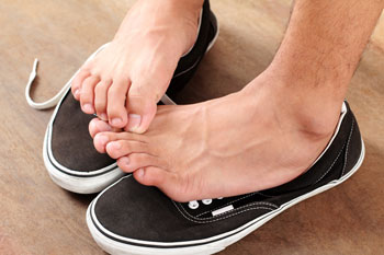 Athletes foot treatment in the Broward County, FL: Fort Lauderdale (Sunrise, Oakland Park, Dania Beach, Lauderhill, Coconut Creek) areas