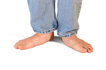 Flat feet and Fallen Arches treatment, Flatfoot Deformity Treatment in the Broward County, FL: Fort Lauderdale (Sunrise, Oakland Park, Dania Beach, Lauderhill, Coconut Creek) areas