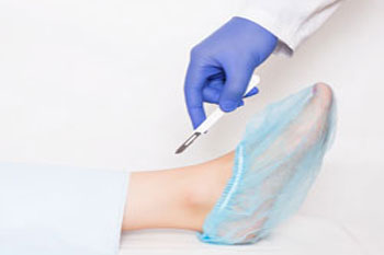 Foot surgery, ankle surgery treatment in the Broward County, FL: Fort Lauderdale (Sunrise, Oakland Park, Dania Beach, Lauderhill, Coconut Creek) areas