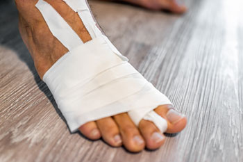 Foot Fractures treatment in the Broward County, FL: Fort Lauderdale (Sunrise, Oakland Park, Dania Beach, Lauderhill, Coconut Creek) areas