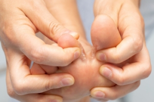 Relief Options for Athlete’s Foot