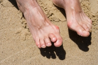 Causes and Symptoms of Hammertoe